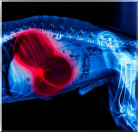 Abdominal x-ray